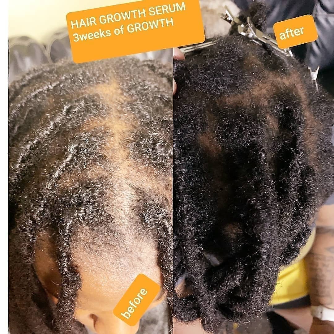 HAIR GROWTH SERUM